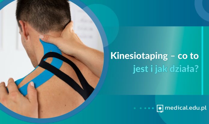 Kinesiotaping – co to jest i jak działa? Kinesiotaping – co to jest i jak działa?